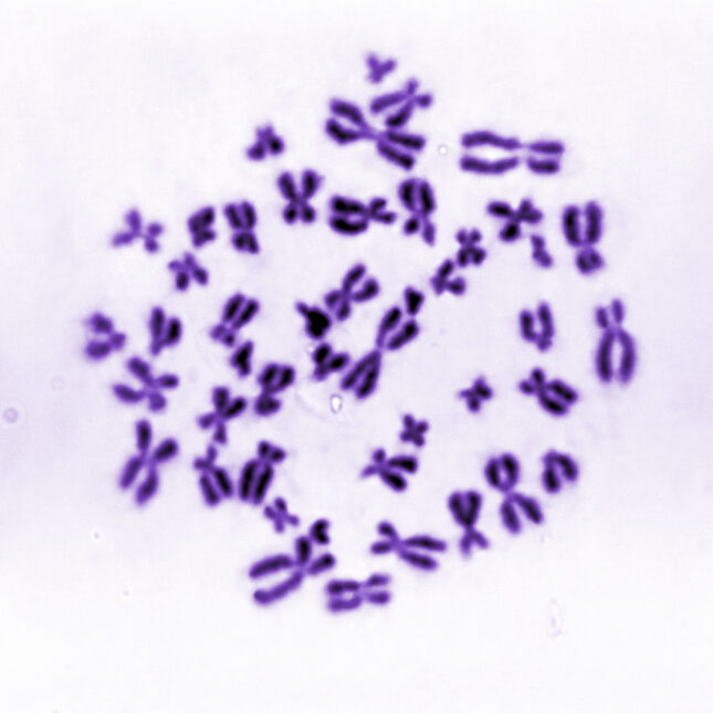 This image depicts a karyotype in hues of purple. -- health coverage from STAT