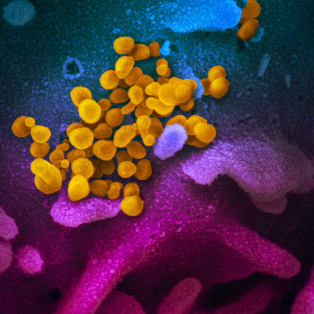 This scanning electron microscope image shows SARS-CoV-2 (yellow)—also known as 2019-nCoV, the virus that causes COVID-19—isolated from a patient in the U.S., emerging from the surface of cells (blue/pink) cultured in the lab – science coverage from STAT