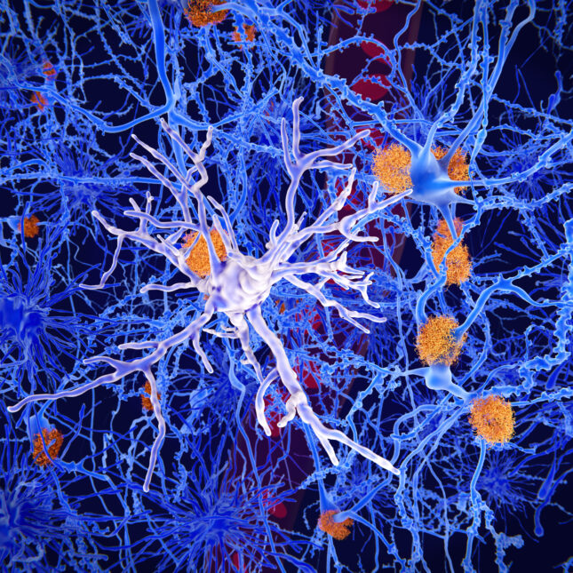 a microglia cell inside a brain – medicare coverage from STAT