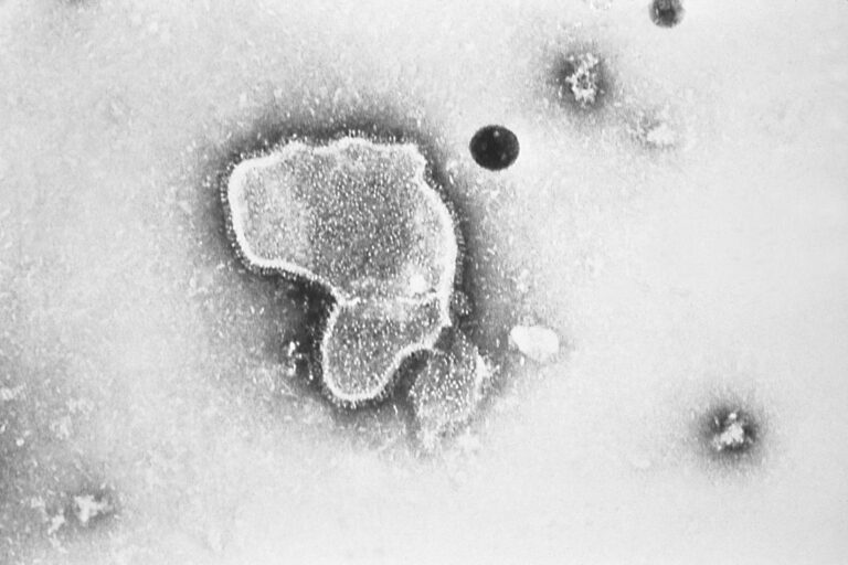 Electron micrograph of Respiratory Syncytial Virus, also known as RSV.