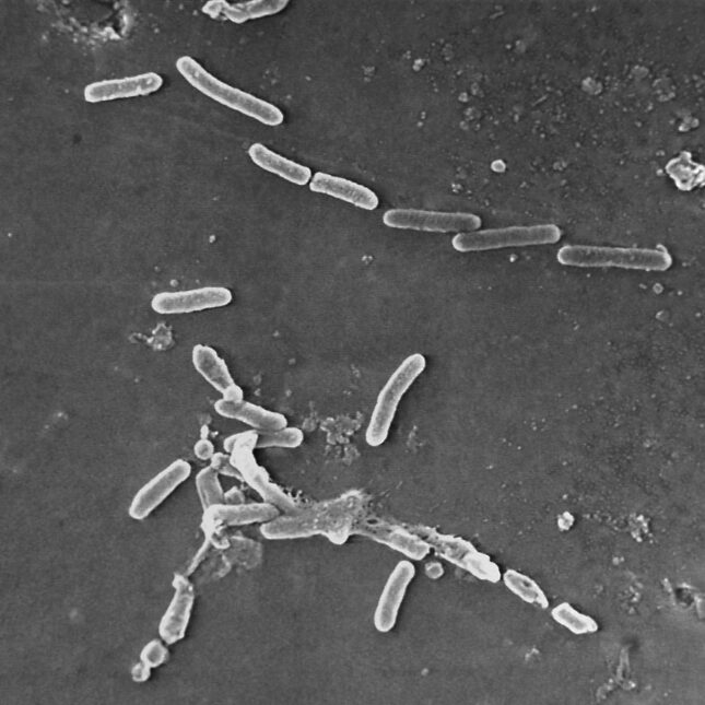 A scanning electron microscope image that shows rod-shaped Pseudomonas aeruginosa bacteria.