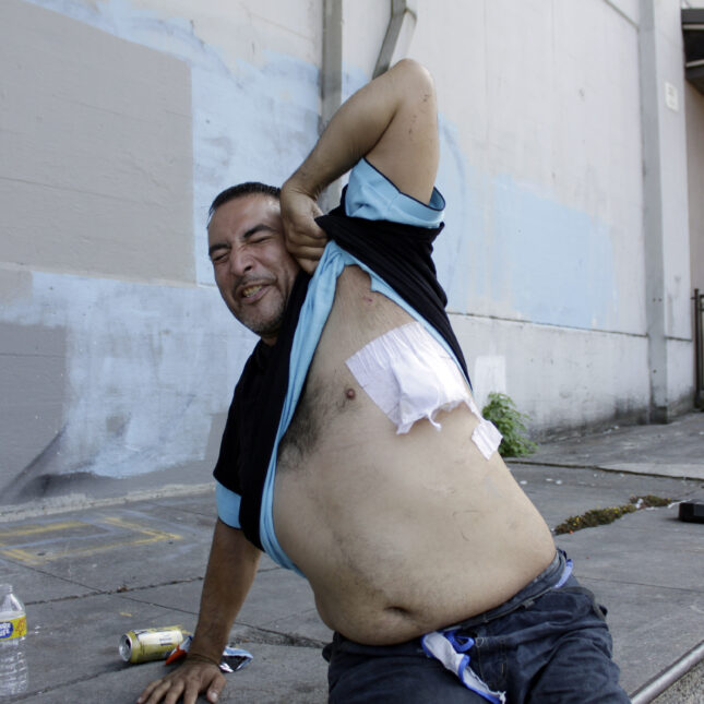 Jeremiah King, who is transitioning out of homelessness, grimaces in pain as he shows the bandage on a gunshot wound as he sits on the street after his hospital release in Portland, Oregon.