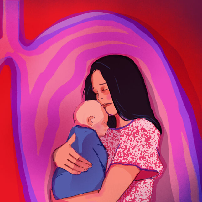Illustrations of lungs. A mother holds her infant child on the right side of the lungs and left lungs show different RSV treatments -- health coverage from STAT