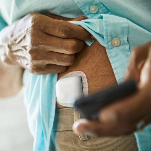 Insulet's insulin patch pump, omnipod, shown on a patient. -- health tech coverage from STAT